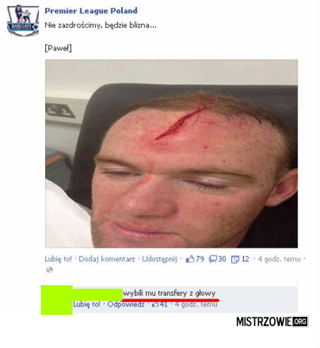 Biedny Rooney –  