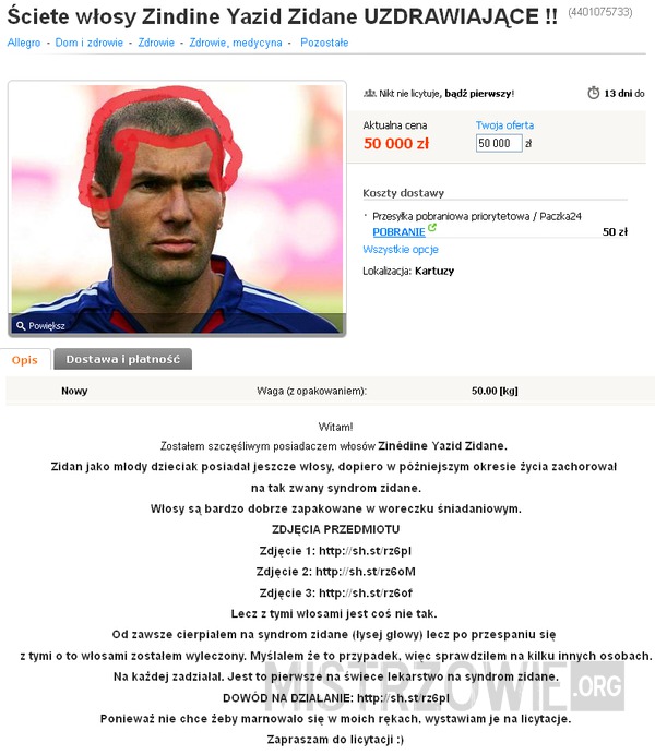 Włosy Zinedine Zidane&apos;a!!! –  